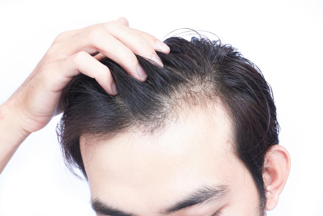 Best Hair Loss Treatment for men and women, Hair Fall Cure, Cost in Mumbai, India