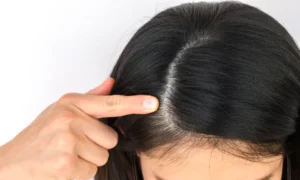 hair loss and thinning treatment