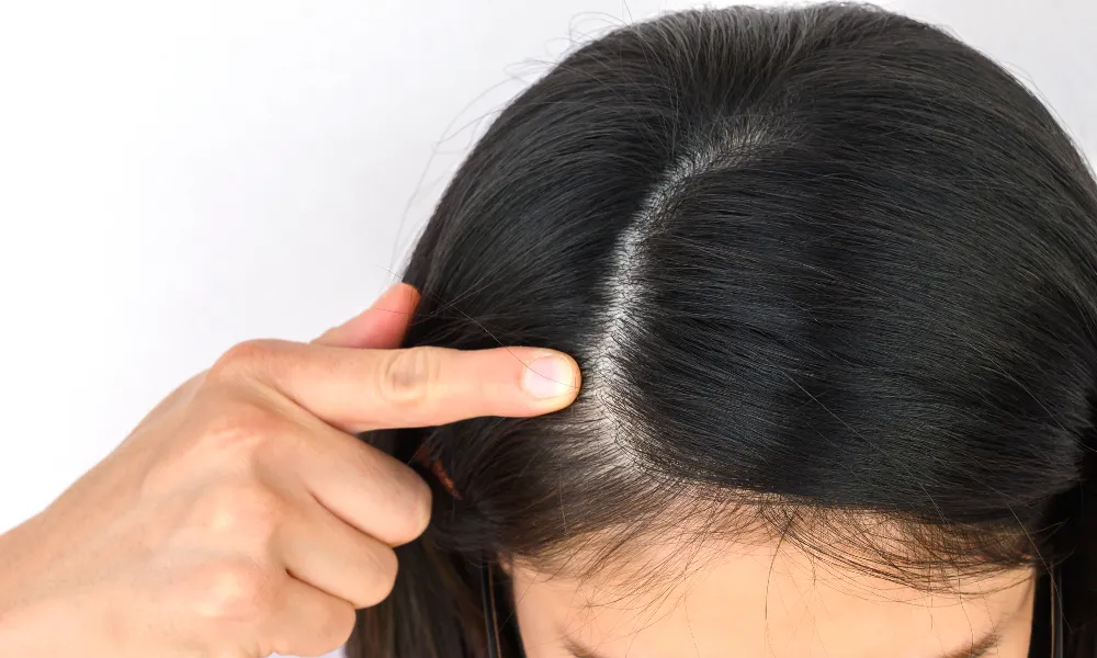 hair loss and thinning treatment
