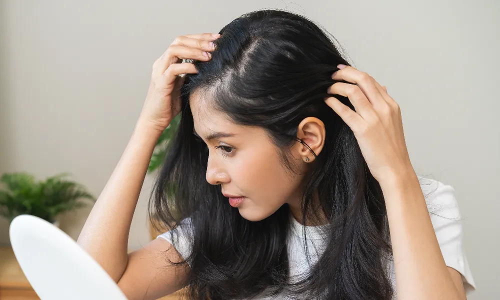 symptoms of alopecia hair loss